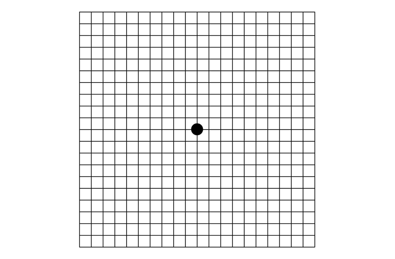 How to Get an Amsler Grid Eye Test at Home